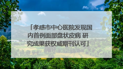孝感市中心医院发现国内首例面部盘状皮病 研究成果获权威期刊认可
